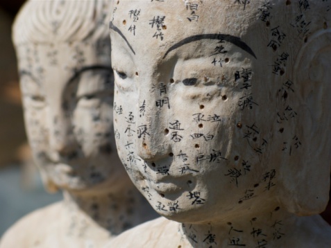 ANALGESIA POR ACUPUNTURA EN EL&nbsp;PARTO