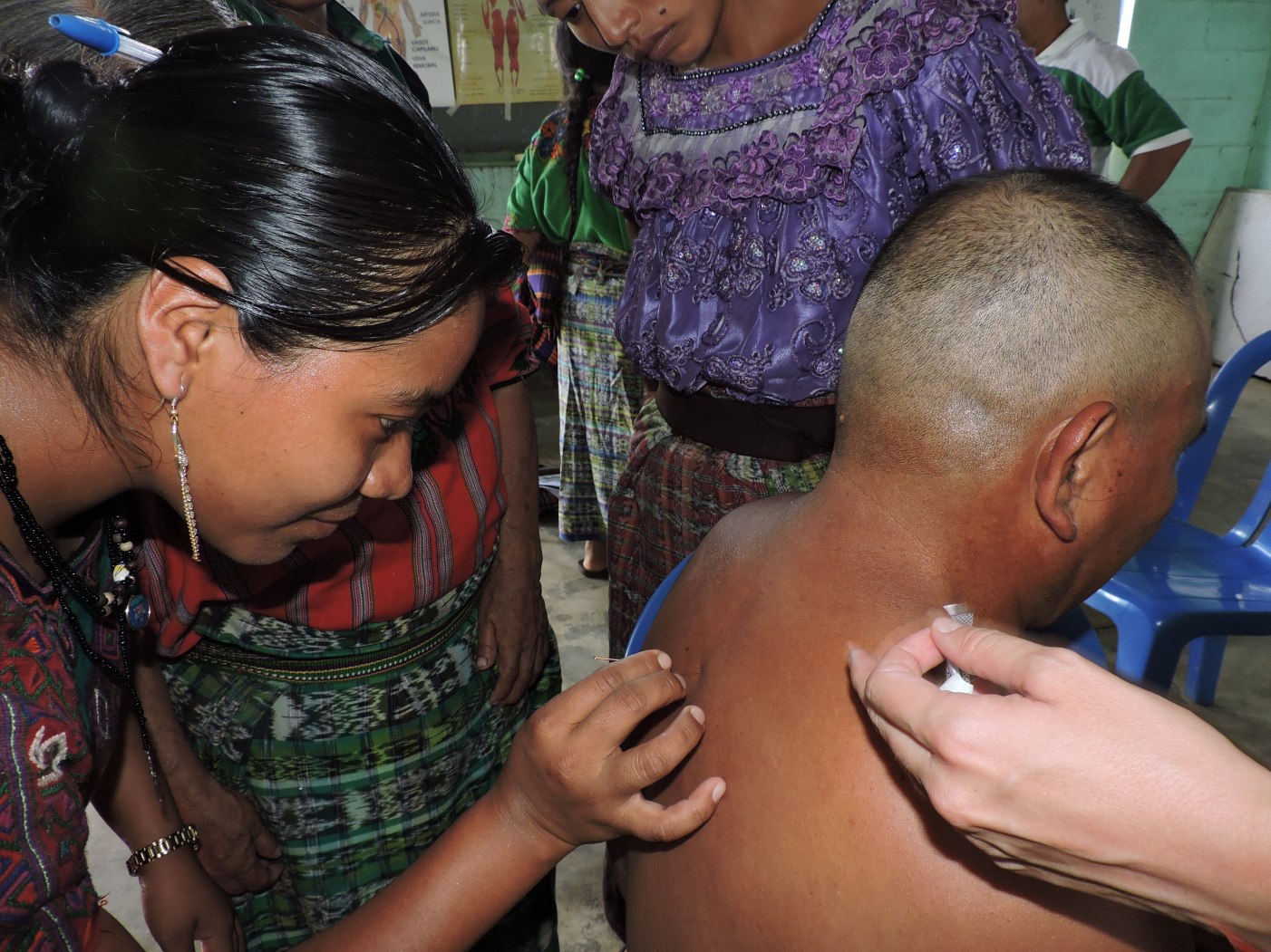 Formando acupuntores y acupuntoras locales