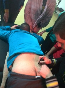 ¿Dónde está el punto? Primero: reconozcamos con precisión la anatomía local...