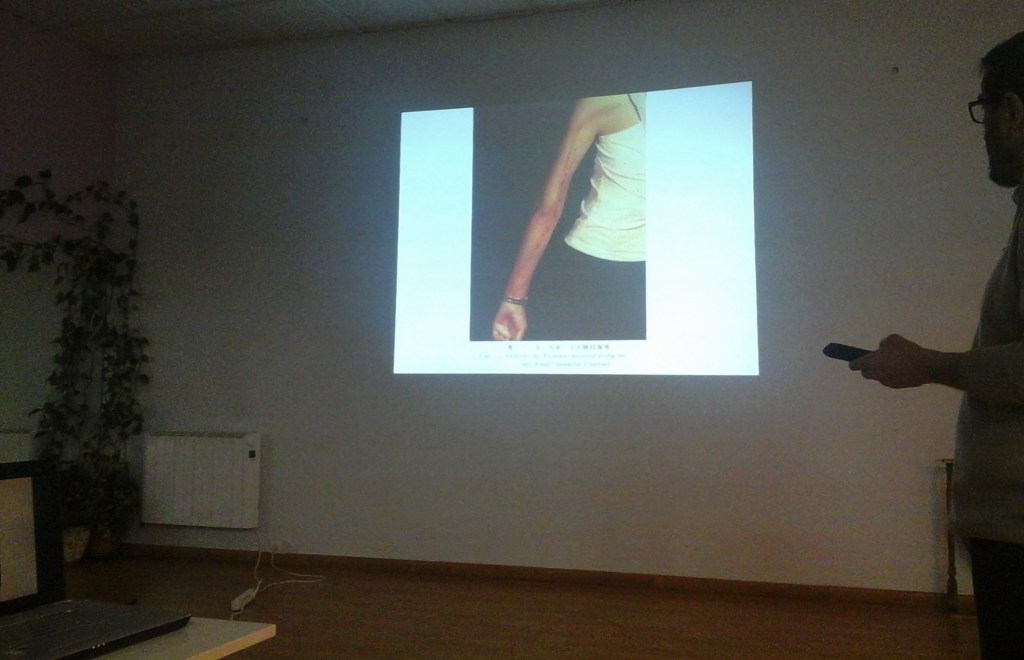 DERMATOSIS MERIDIANAS EN ID