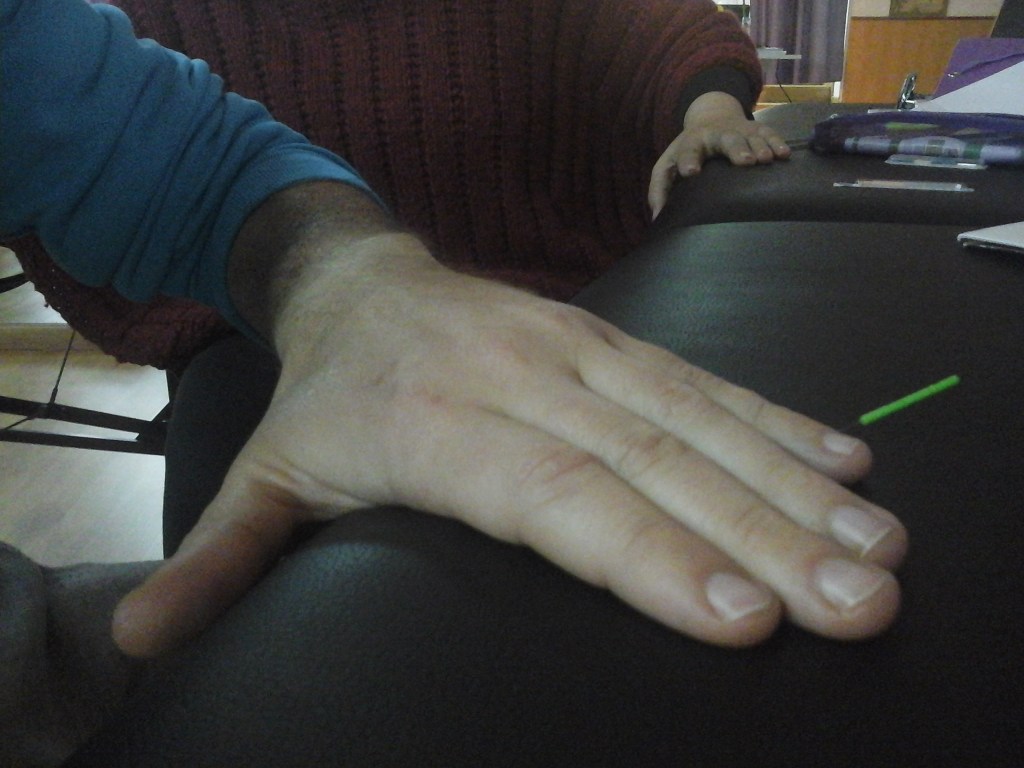 Practicar sobre uno mismo. Prediendo el miedo. Gestionando las sensaciones de ligero dolor, picor, entumecimiento...para poder comprender al paciente y tranquilizarle, comprenderle mejor