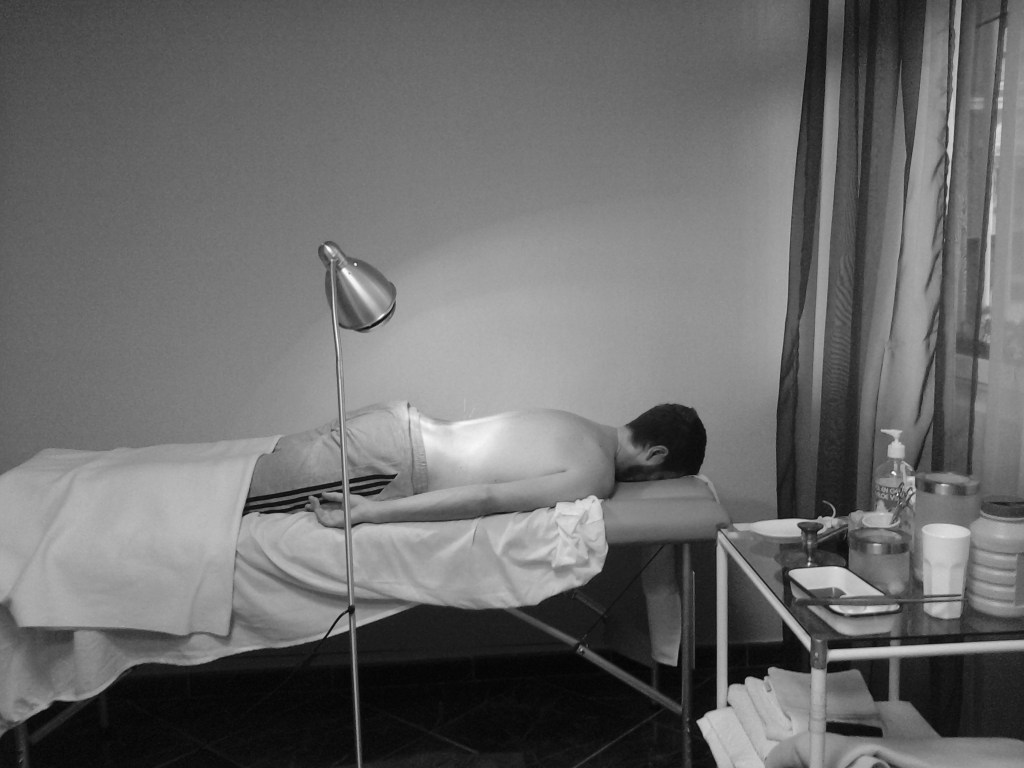  Alumnos. Tratamiento para la tonificación del Yang de R con acupuntura e infrarojos