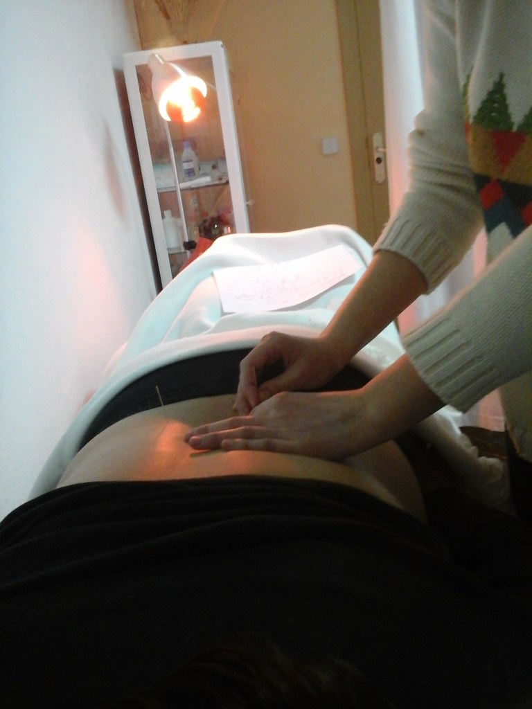 alumn@s en prácticas de acupuntura