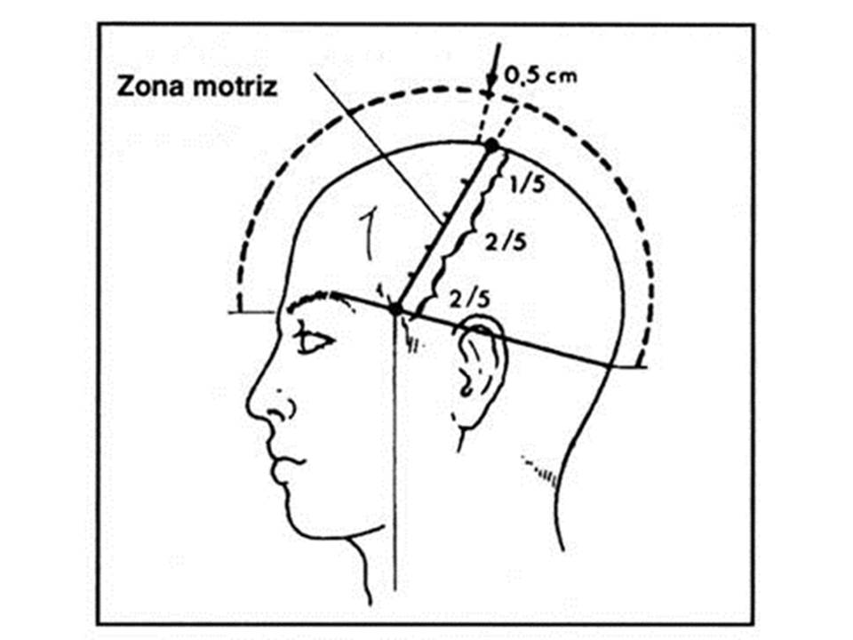 CRANEO-PUNTURA, Febrero días 16 Y&nbsp;17