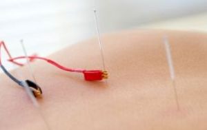 Lok_Electro_Acupuncture