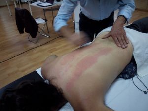 Gua Sha
