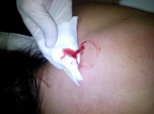 Distinguir las texturas de la sangre...