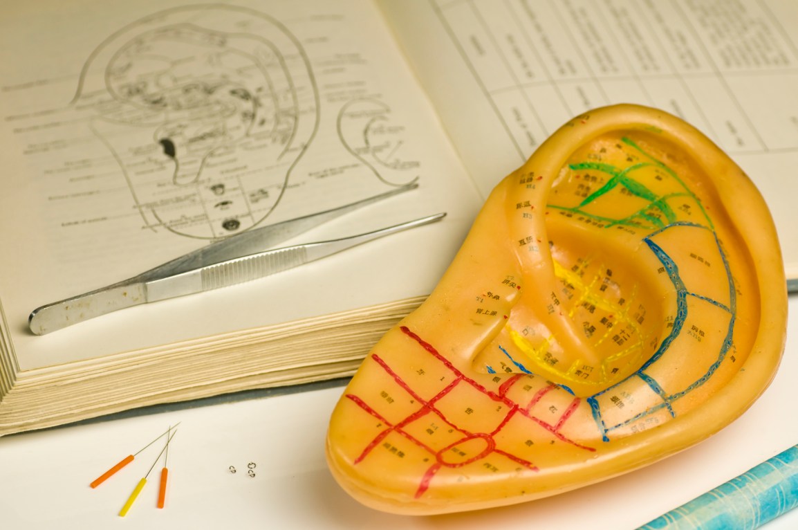 AURICULOPUNTURA (Seminario)