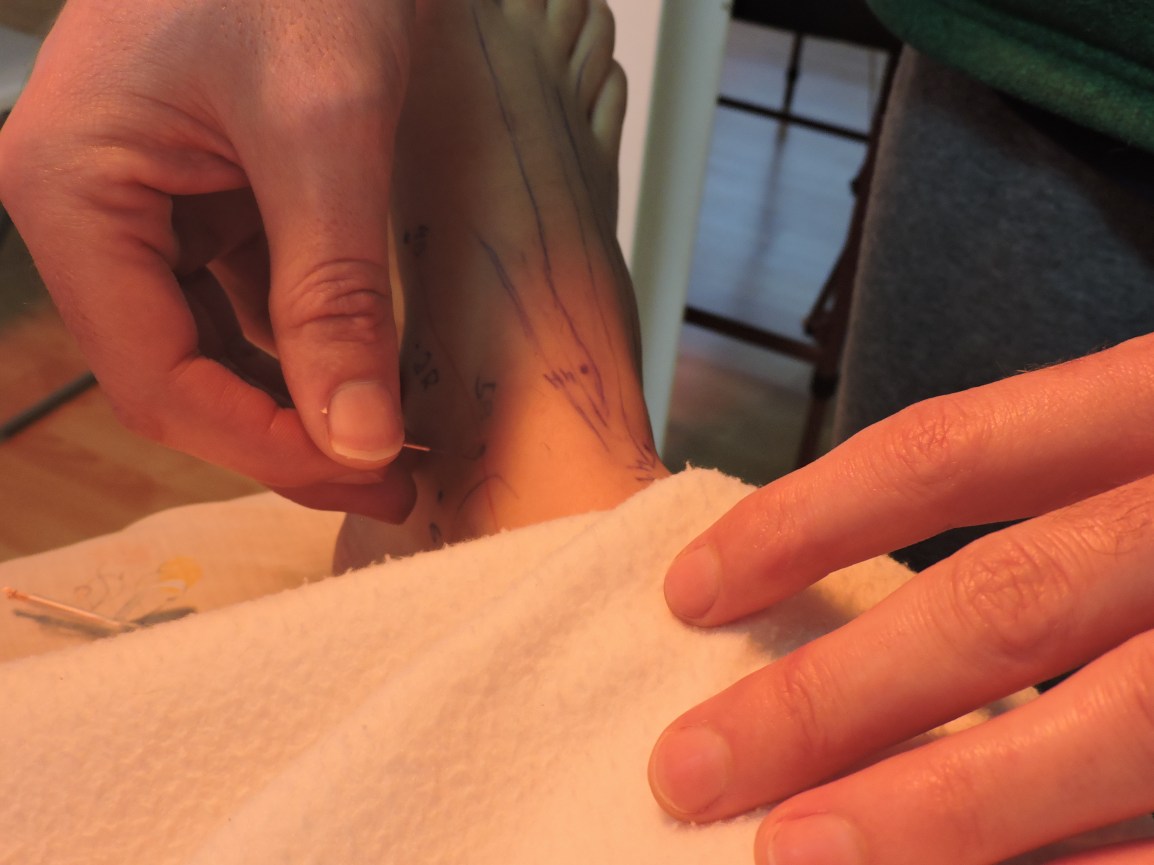 Diagnóstico por PULSO y LENGUA en MTC,&nbsp;SEMINARIO