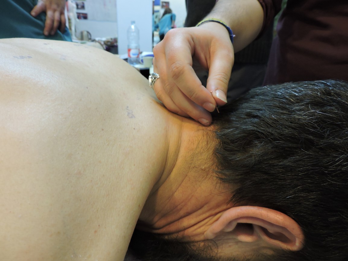 ACUPUNTURA+ACUPUNTURA, enero 2017&nbsp;(Imágenes)