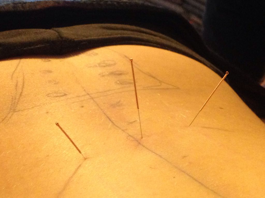 EN IMÁGENES, como van los cursos de ACUPUNTURA este&nbsp;año….