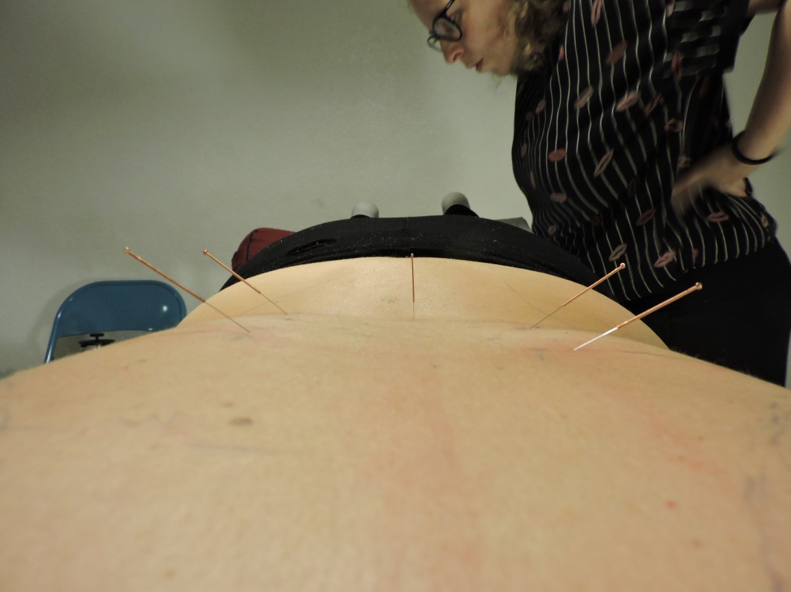 18 de nov EN IMÁGENES, un seminario de ACUPUNTURA&nbsp;Y+