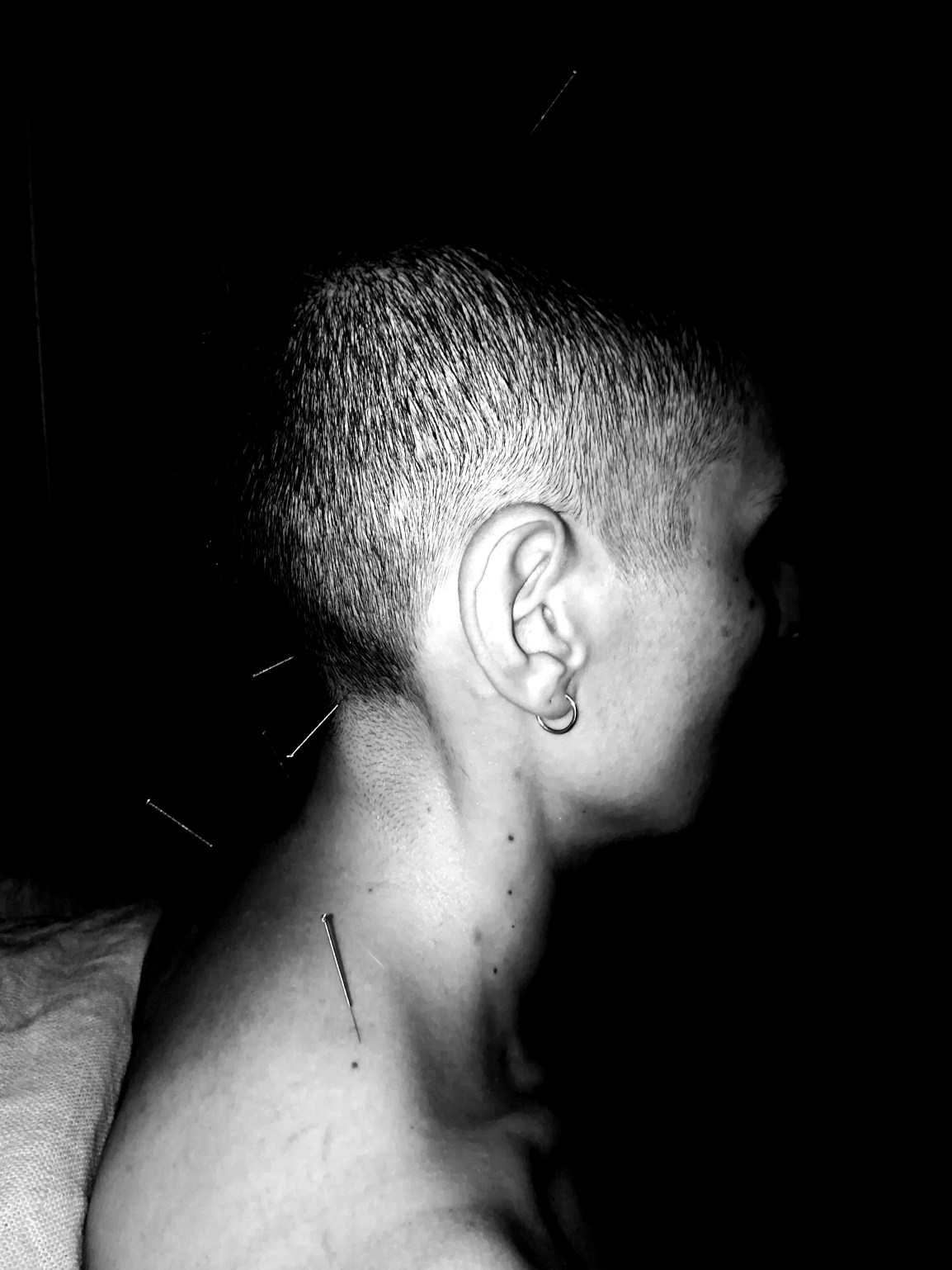 NUEVO CURSO DE ACUPUNTURA de 3&nbsp;AÑOS